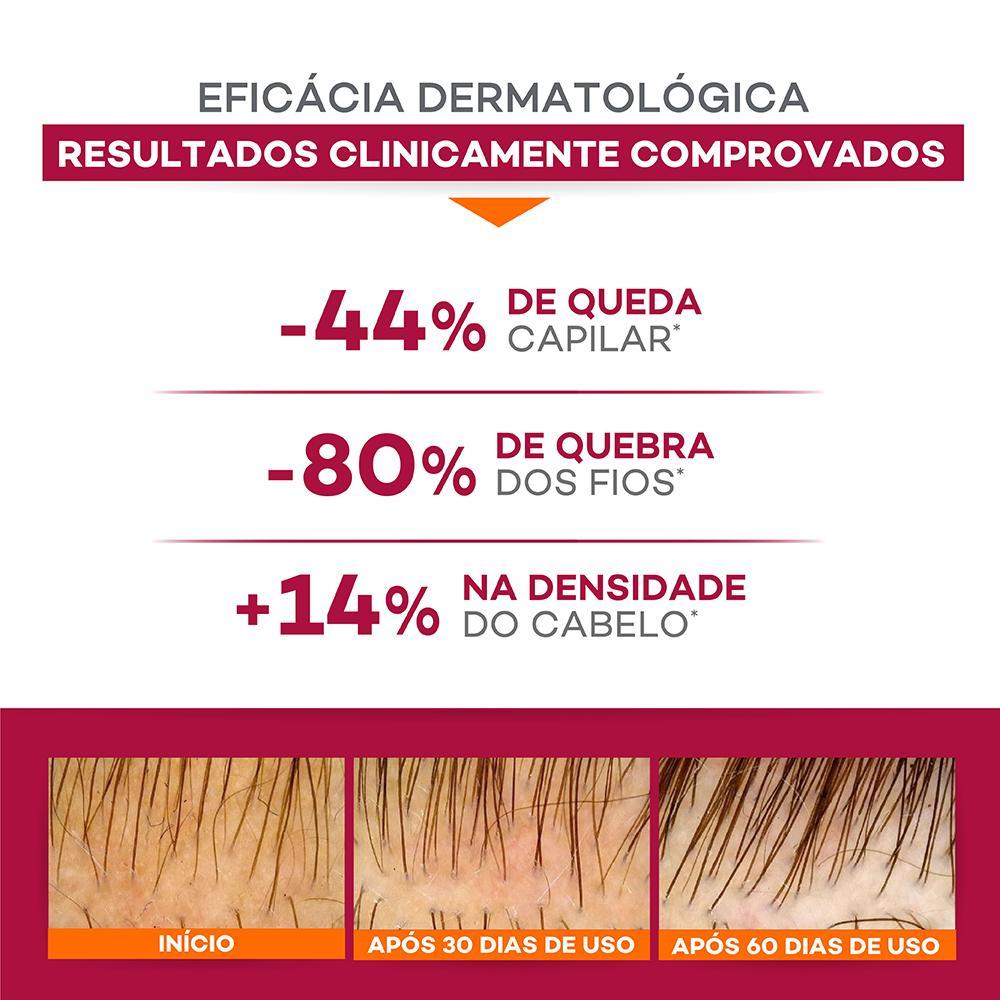 Darrow Doctar Force Shampoo Antiqueda 200ml - 5