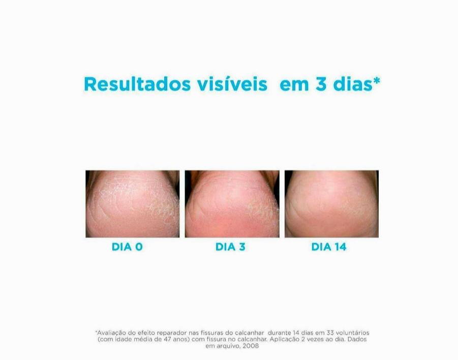 Hidratante para os Pés Isdin Foot Care Ureadin Podos Gel 80,25g - 3