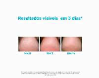 Hidratante para os Pés Isdin Foot Care Ureadin Podos Gel 80,25g - 3