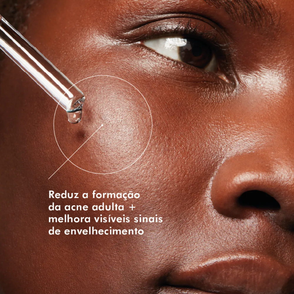 Sérum Facial SkinCeuticals Blemish + Age Defense 30ml - 5