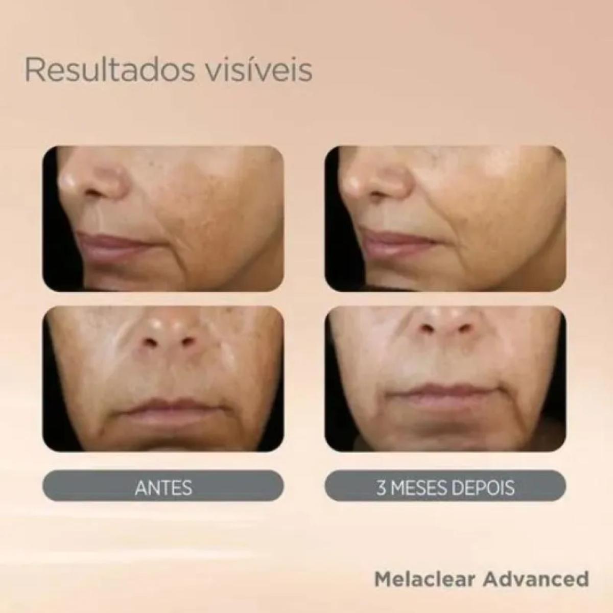 Sérum Isdinceutics Melaclear Advanced 30ml - 5