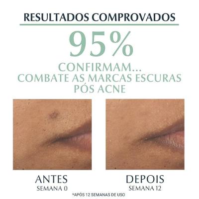 Sérum Facial Efeito Triplo Antiacne Eucerin Dermopure Oil Control 40ml