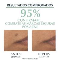 Sérum Facial Antiacne Eucerin Dermo Pure Efeito Triplo 40ml - 4