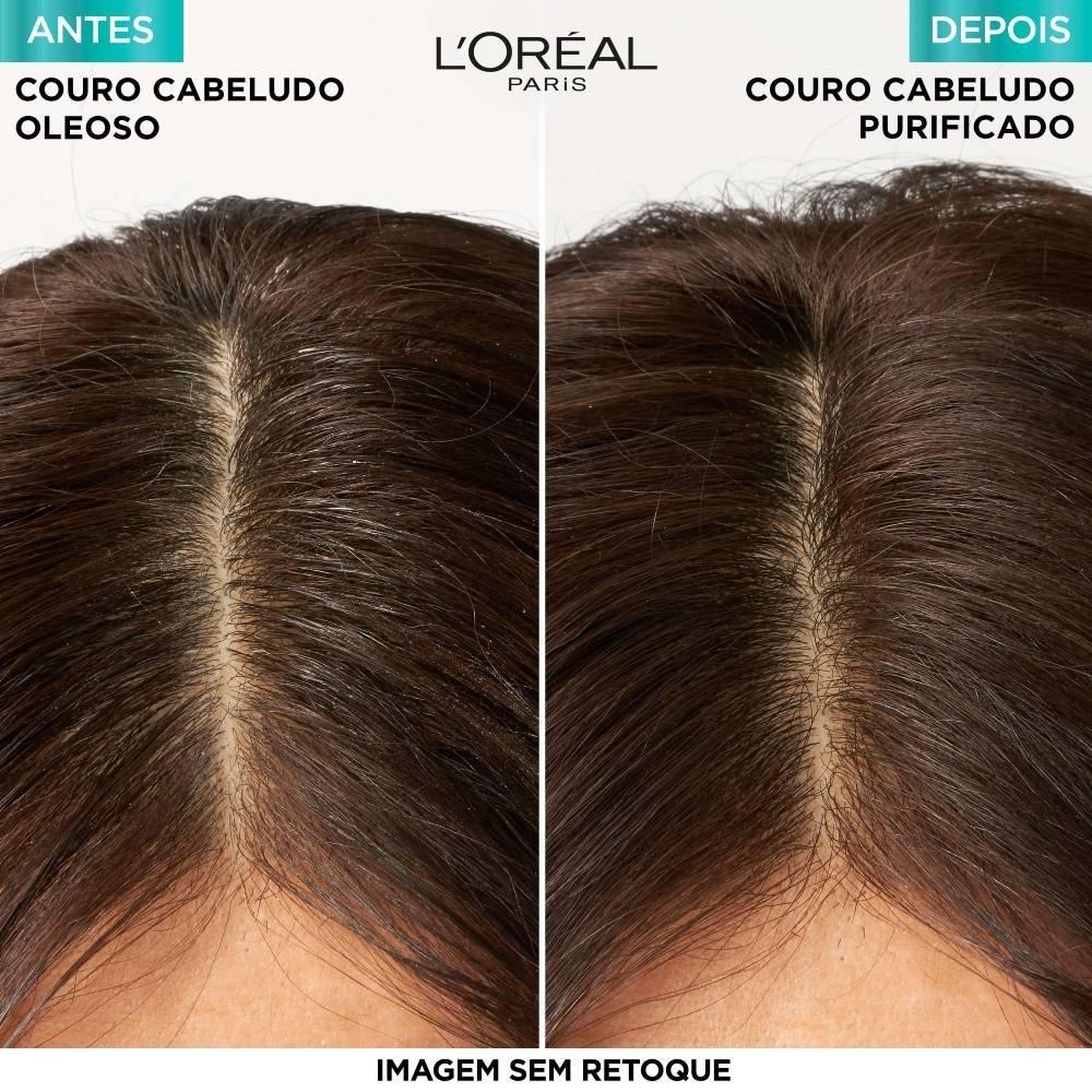 Shampoo L’oréal Paris Elseve Pure Hialurônico 400ml - 5