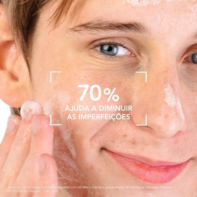 Gel De Limpeza Facial Bioderma Antiacne Sébium Gel Moussant Actif 500ml