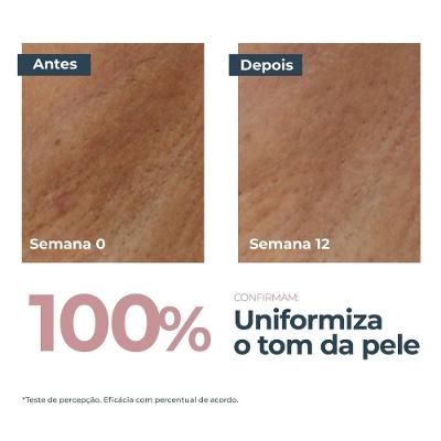 Sérum Corporal Eucerin Áreas Sensíveis Anti-pigment 75ml