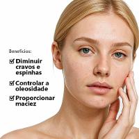 Kit Principia Antiacne Gel Limpeza Gl-01 + Sérum Niacinamida 10% + Sérum Mix-01 + Tônico Al-7 - 4