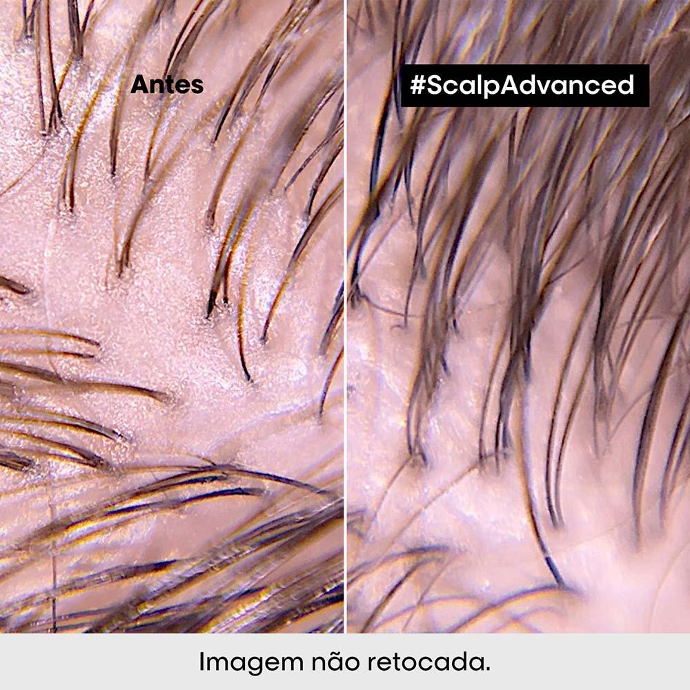 L'Oréal Professionnel Scalp Shampoo Purificante - 4