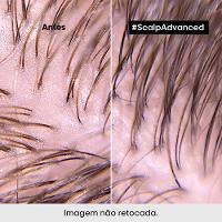 L'Oréal Professionnel Scalp Shampoo Purificante