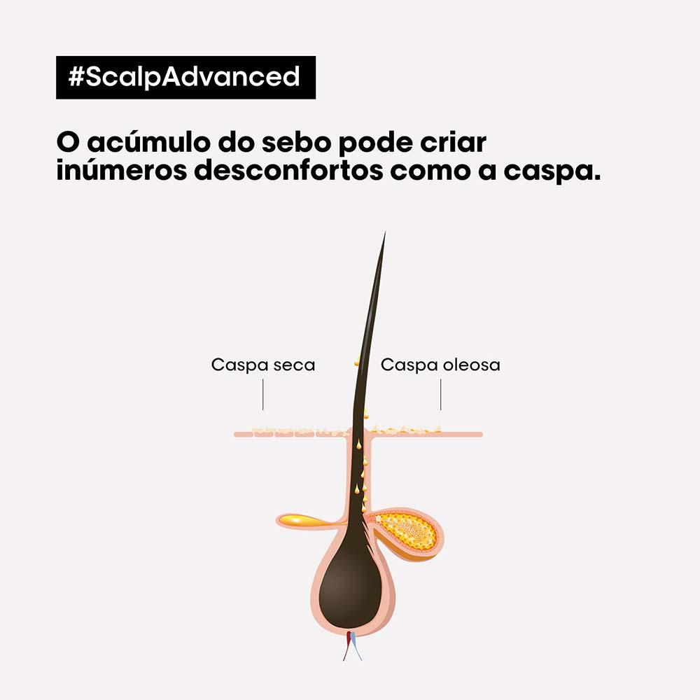 L'Oréal Professionnel Scalp Dermo Clarifier Shampoo Anticaspa - 2