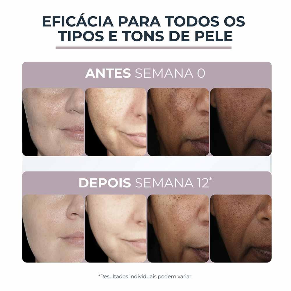 Creme Facial Eucerin Anti-Pigment Noite - 6