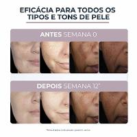 Creme Facial Eucerin Anti-Pigment Noite - 6