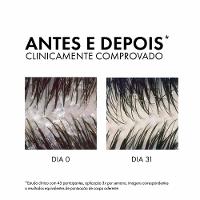 Vichy Dercos Shampoo Anticaspa DS - Cabelos Normais a Oleosos Refil - 5