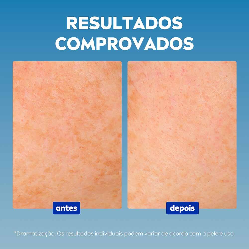 Sérum Facial NIVEA Cellular Luminous 630° com Ácido Hialurônico - 5