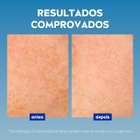 Sérum Facial NIVEA Cellular Luminous 630° com Ácido Hialurônico - 5