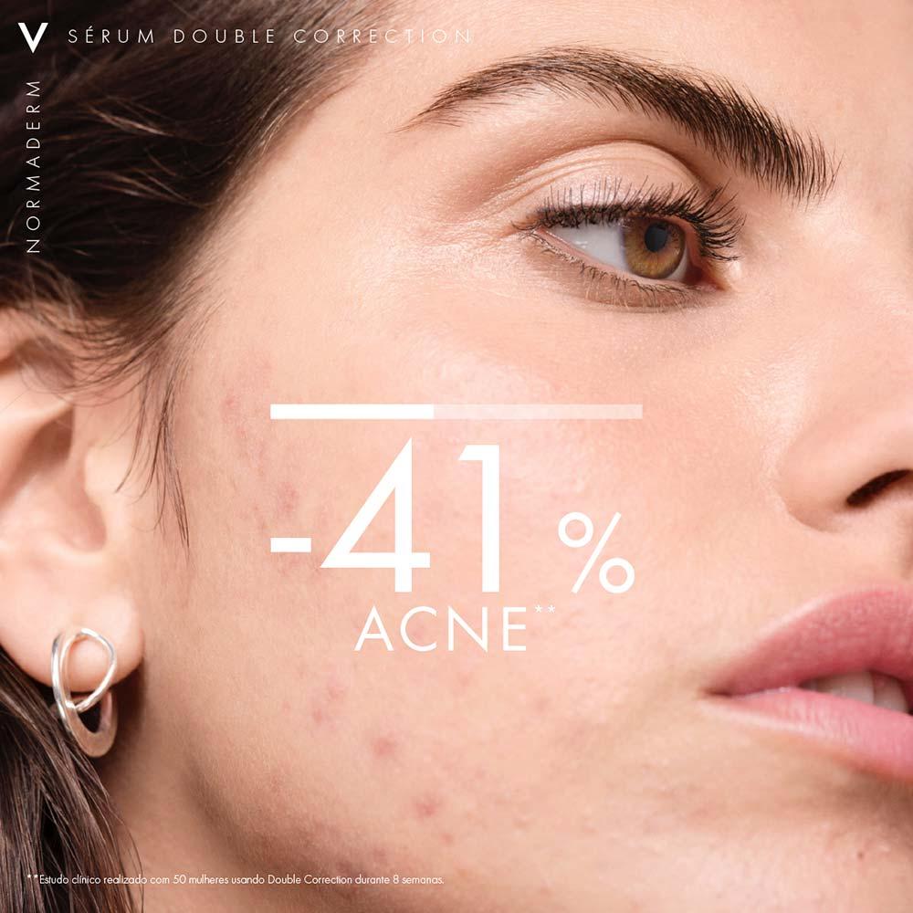 Sérum Antioleosidade e Antiacne Vichy Normaderm Phytosolution - 5