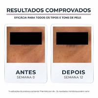 Clareador De Olheiras Eucerin Anti-Pigment - 6