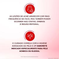 Sabonete Líquido Facial para Pele Muito Oleosa e Acneica Dermotivin Salix - 8