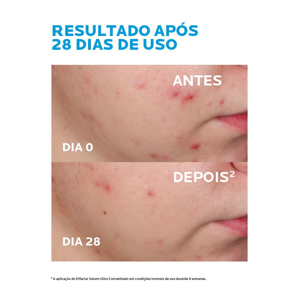 Sérum Effaclar Ultra Concentrado – La Roche-Posay - 7