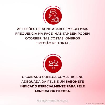 Sabonete Líquido Facial para Pele Muito Oleosa e Acneica Dermotivin Salix