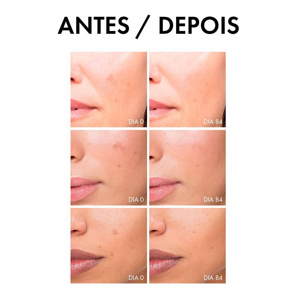 Sérum Antimanchas Vichy Liftactiv Pigment Specialist B3 - 9