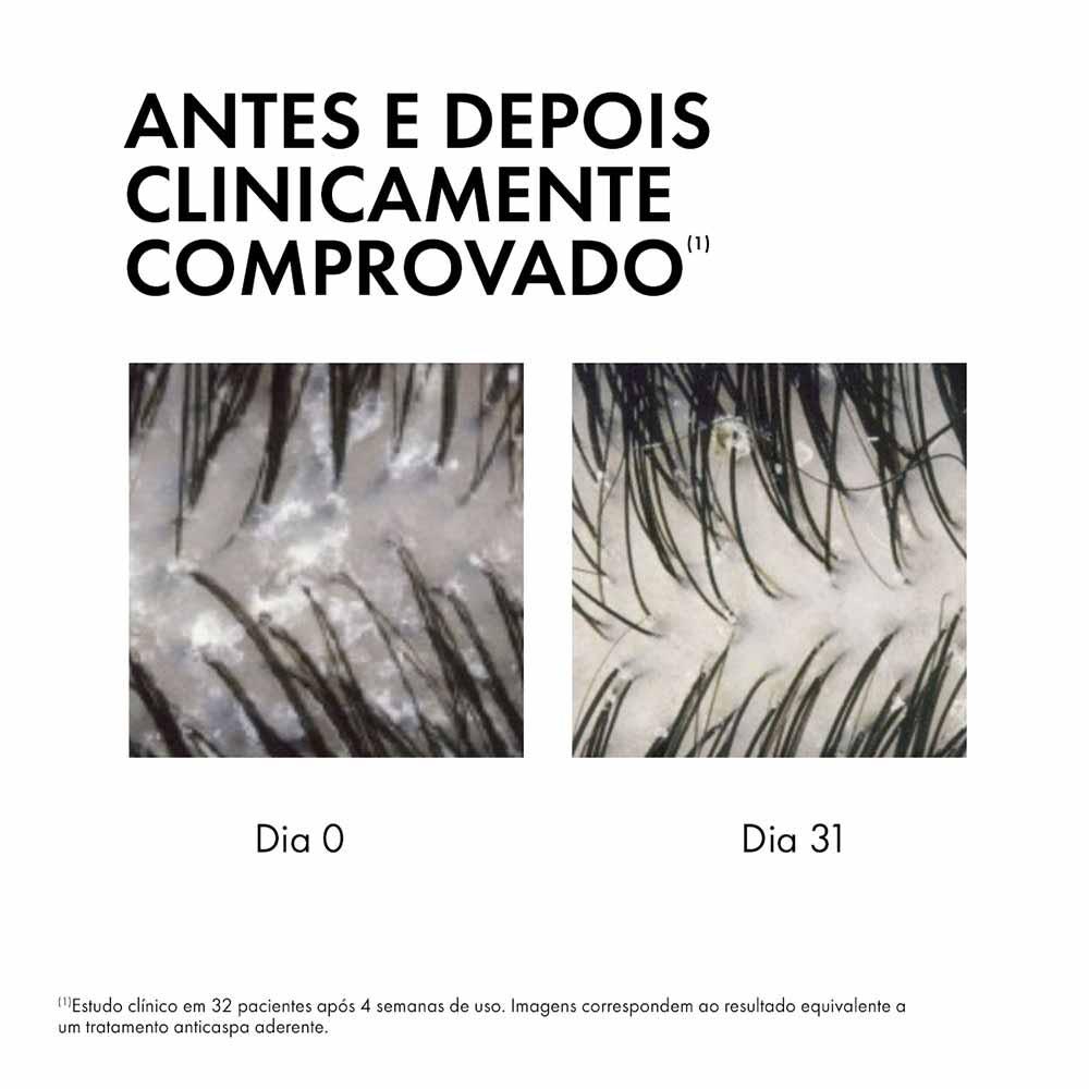 Sérum 10 Vichy Dercos Anticaspa - 8