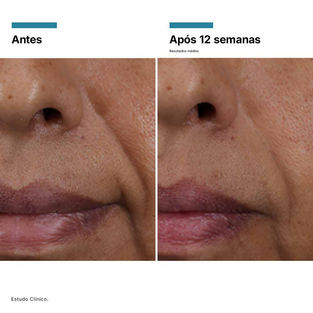 Sérum Facial Skinceuticals HA Intensifier Multi-Glycan - 7