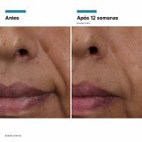 Sérum Facial Skinceuticals HA Intensifier Multi-Glycan - 7