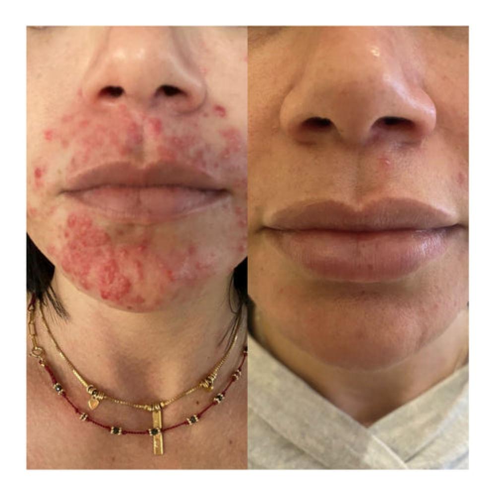 Sérum Molecular Facial Hidratante e Antioxidante Olera - 4