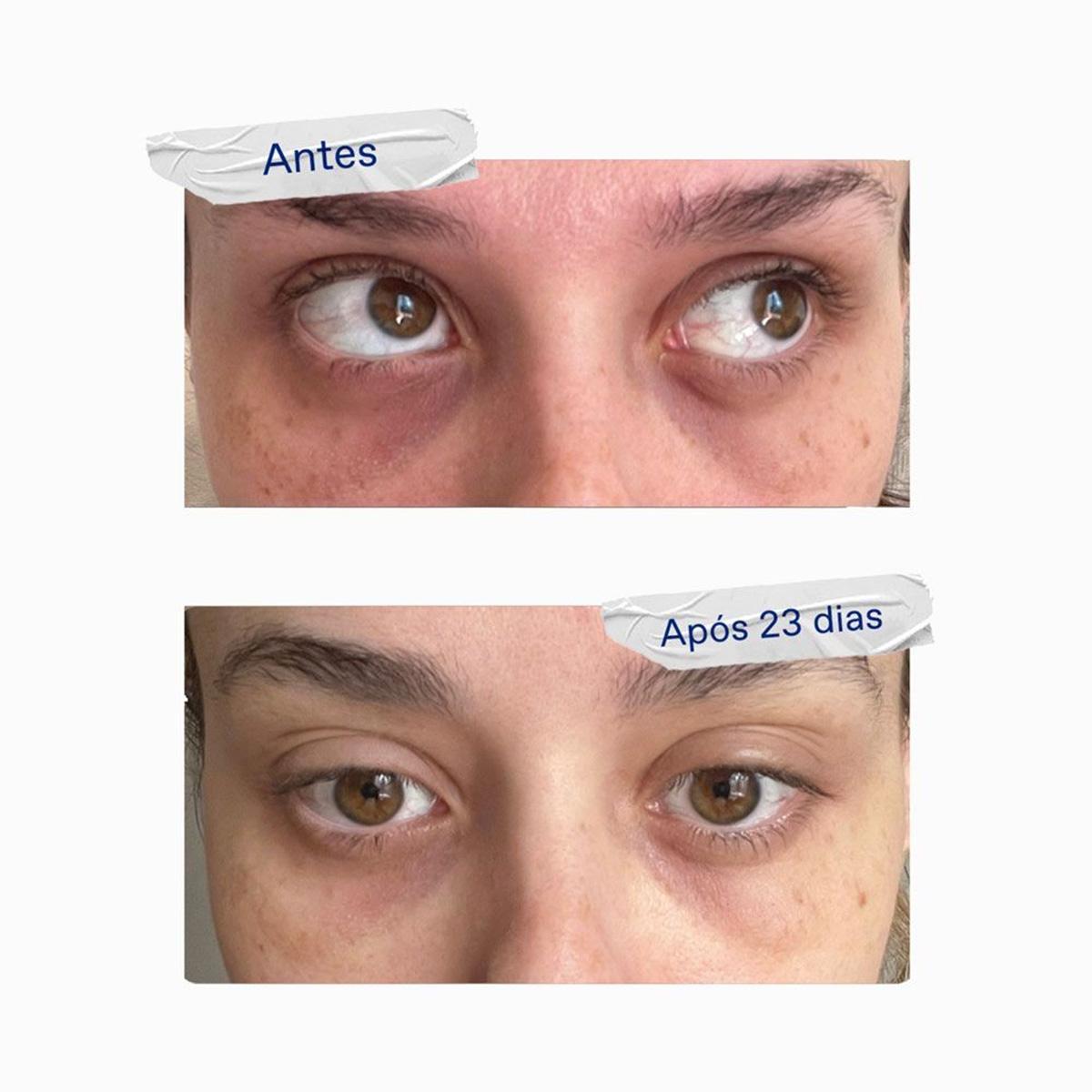 Korres Greek Yoghurt Antifadiga - Sérum Gel para Olhos 15ml - 5