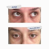 Korres Greek Yoghurt Antifadiga - Sérum Gel para Olhos 15ml - 5