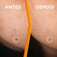 Sérum Facial Garnier Uniforme & Matte Vitamina C 30ml - 6