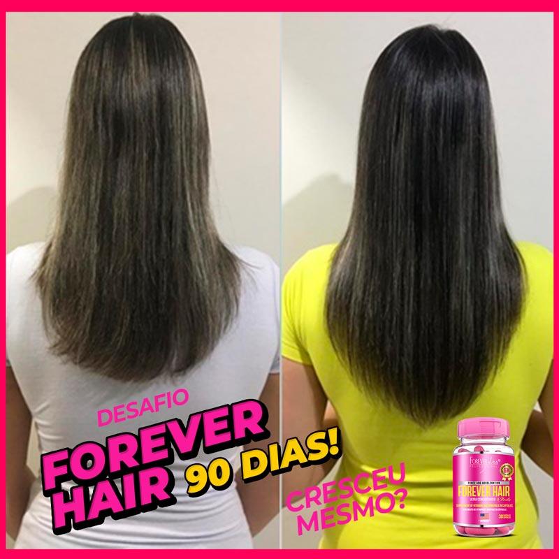Combo Tratamento 3 Meses Forever Hair Crescimento Capilar - 2
