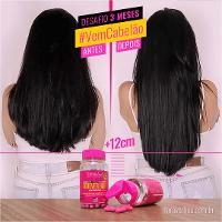 Combo Tratamento 3 Meses Forever Hair Crescimento Capilar - 3