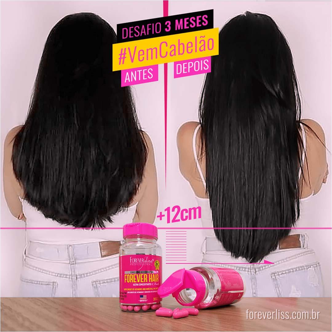 Combo Tratamento 3 Meses Forever Hair Crescimento Capilar - 2