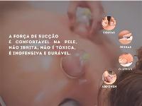 Kit 18 Ventosas com Bomba Ventosaterapia Massoterapia Gadnic - 4