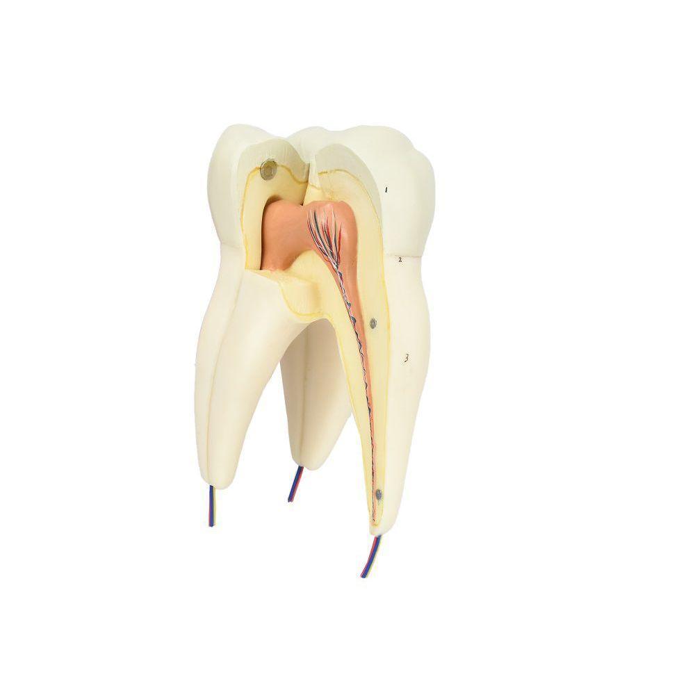 Dente Molar Superior C/ Raiz Tripla Em 3 Partes, 8x - 1