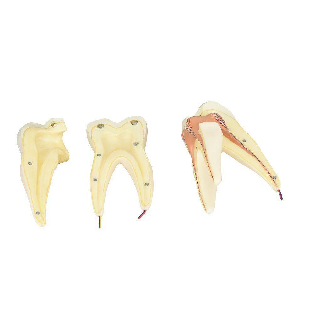 Dente Molar Superior C/ Raiz Tripla Em 3 Partes, 8x - 4