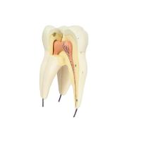 Dente Molar Superior C/ Raiz Tripla Em 3 Partes, 8x - 1