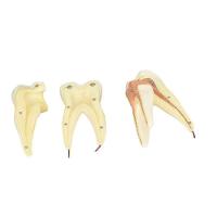 Dente Molar Superior C/ Raiz Tripla Em 3 Partes, 8x - 4