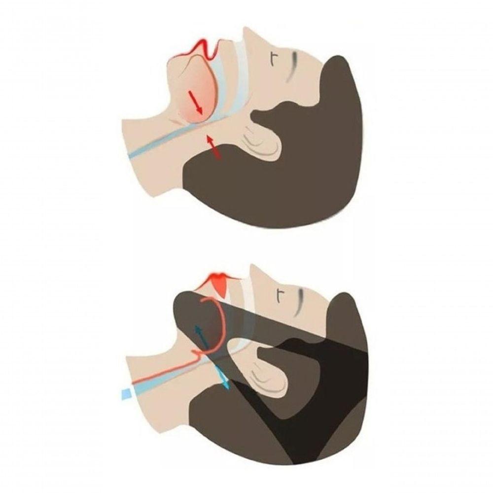 Faixa Elástica Queixeira Anti Ronco Apneia Cabeça 3 Pontas - 2