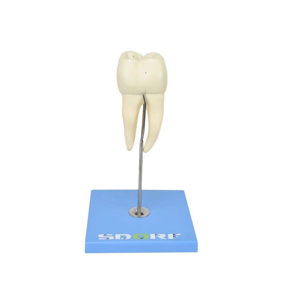 Dente Molar Inferior C/ Raiz Dupla Em 3 Partes C/ Cárie, 8x - 1
