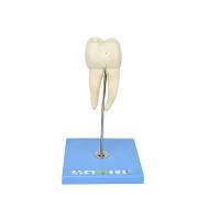 Dente Molar Inferior C/ Raiz Dupla Em 3 Partes C/ Cárie, 8x - 1