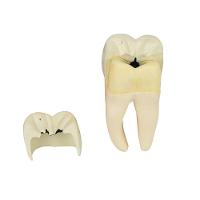 Dente Molar Inferior C/ Raiz Dupla Em 3 Partes C/ Cárie, 8x - 3