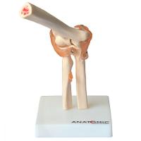 Articulação do Cotovelo com Ligamentos Esqueleto Anatomic - 1