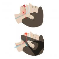 Faixa Anti Ronco Dortler Elástica Ajustável Queixeira Apneia - 2