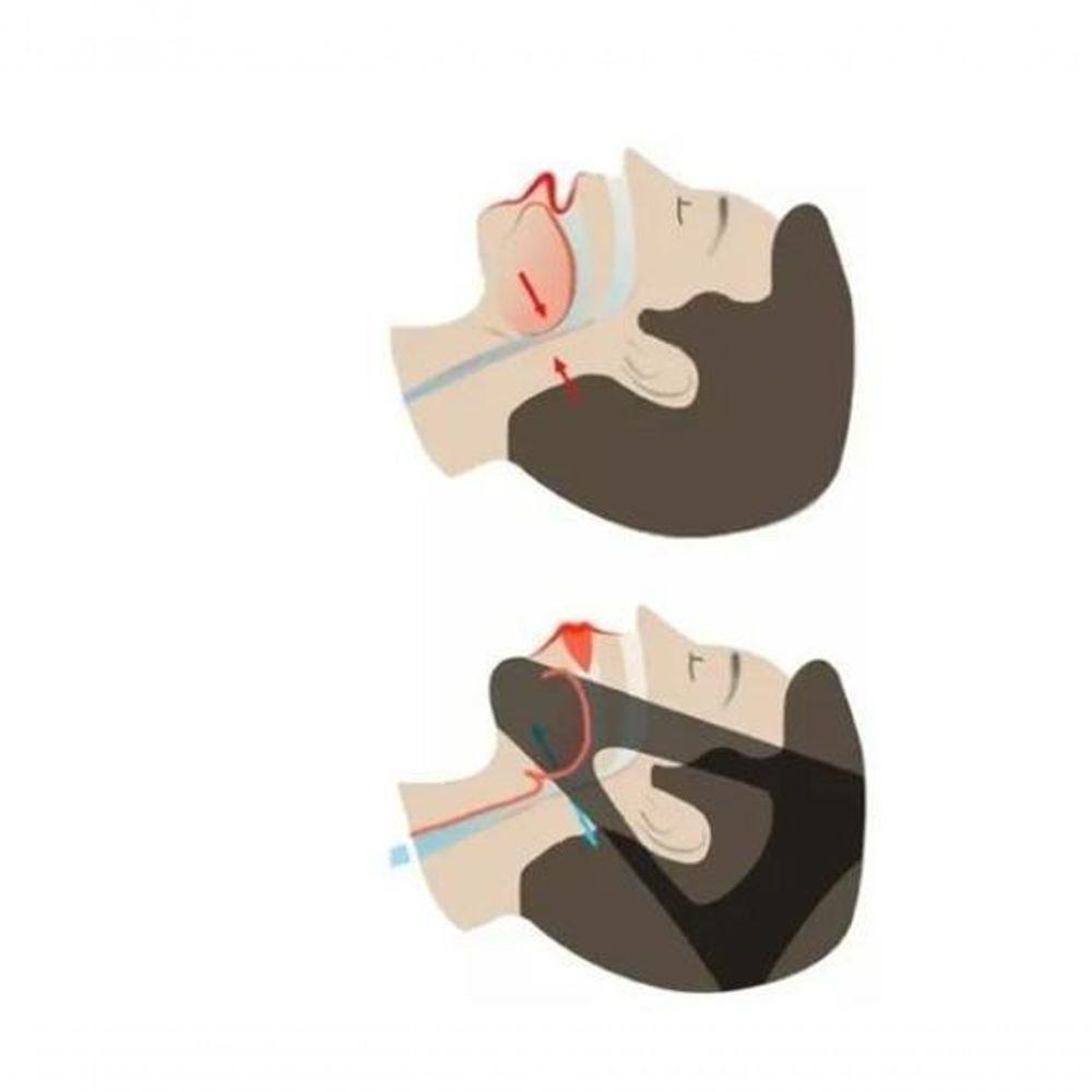 Faixa Mandibular Dortler Ajustável Elástica Compressão Ronco - 4