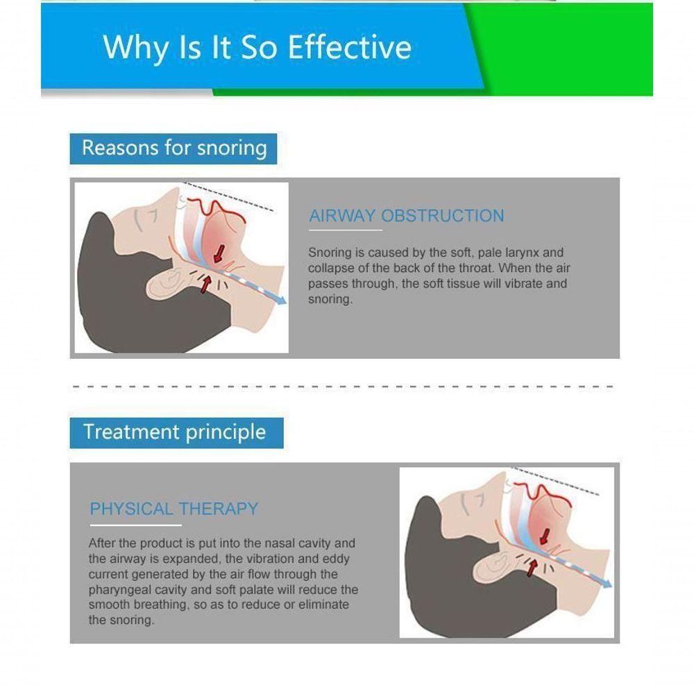 Aparelho Nasal Anti Ronco 4 Peças Com Case - 4