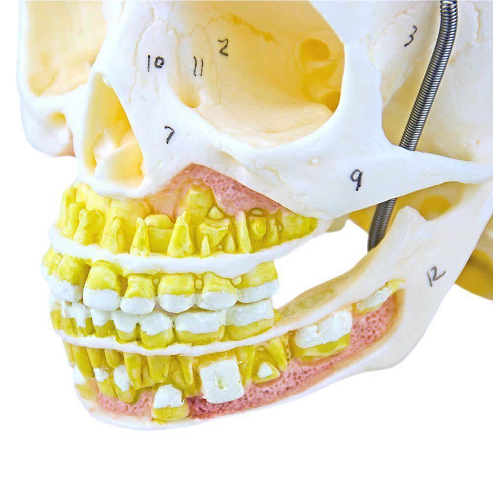Crânio Infantil com Mandíbula Aberta em 2 Partes - 4