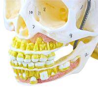 Crânio Infantil com Mandíbula Aberta em 2 Partes - 7